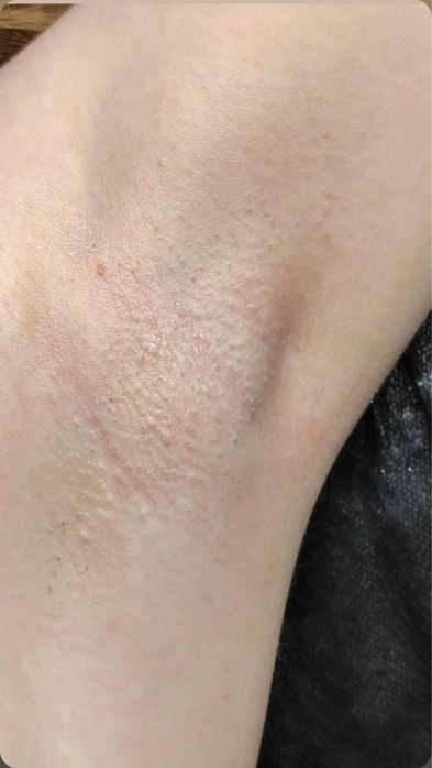 Запрошую на воскову депіляцію