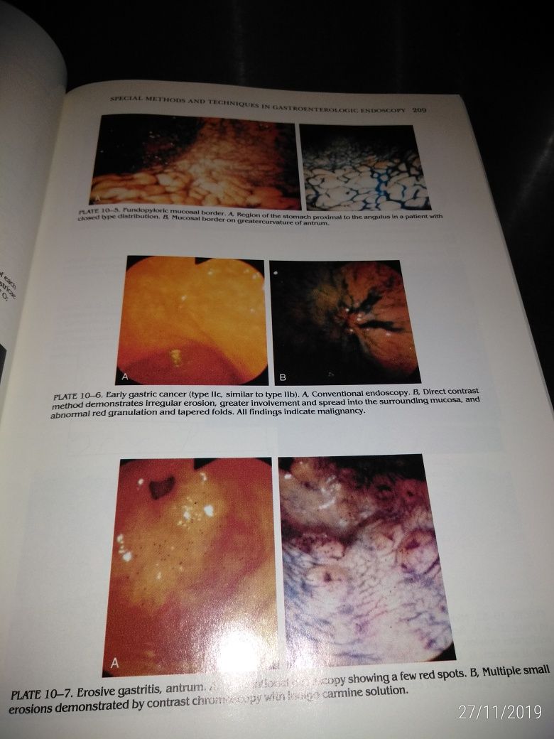 Livro de Medicina "Gastroenterologic Endoscopy"