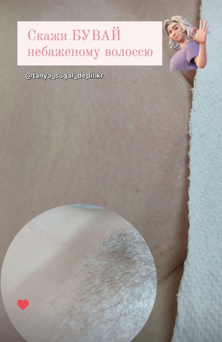 173 кв Шугаринг, депіляція жіноча, чоловіча