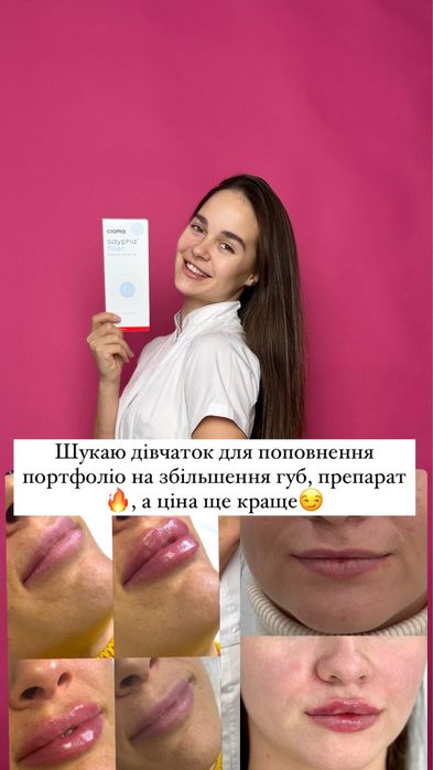 Шукаю моделей на контурну пластику губ,препарати тільки сертифіковані