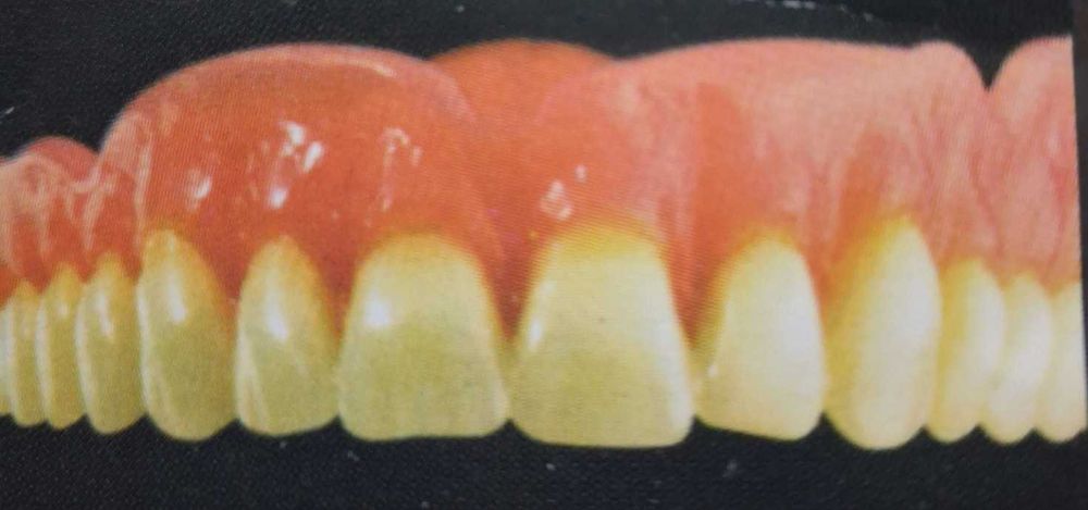 Naprawa protez zębowych