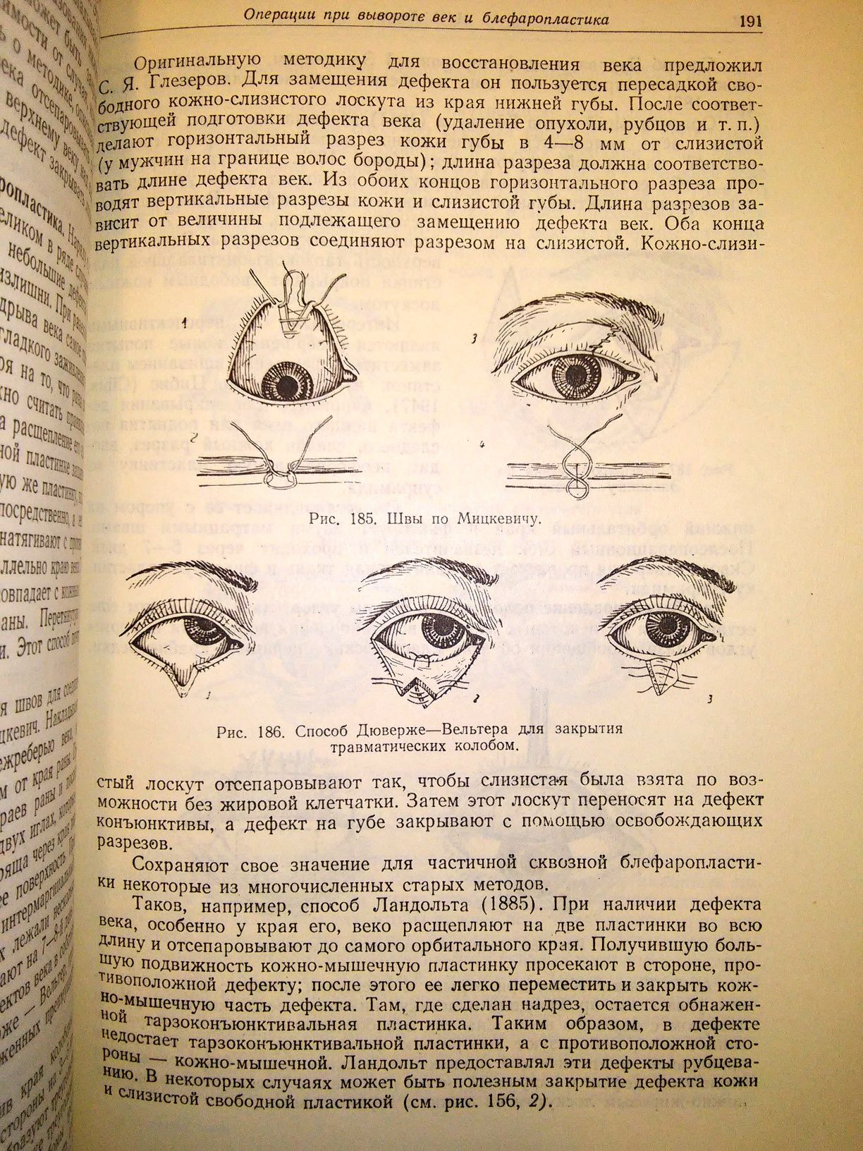 Плетнева Хирургия вспомогательных органов глаза 1959