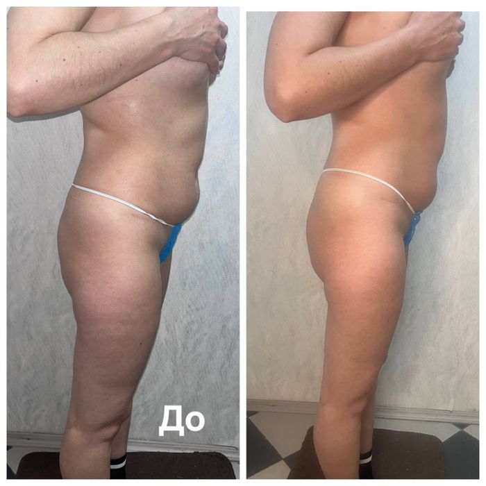 Масажист реабілітолог