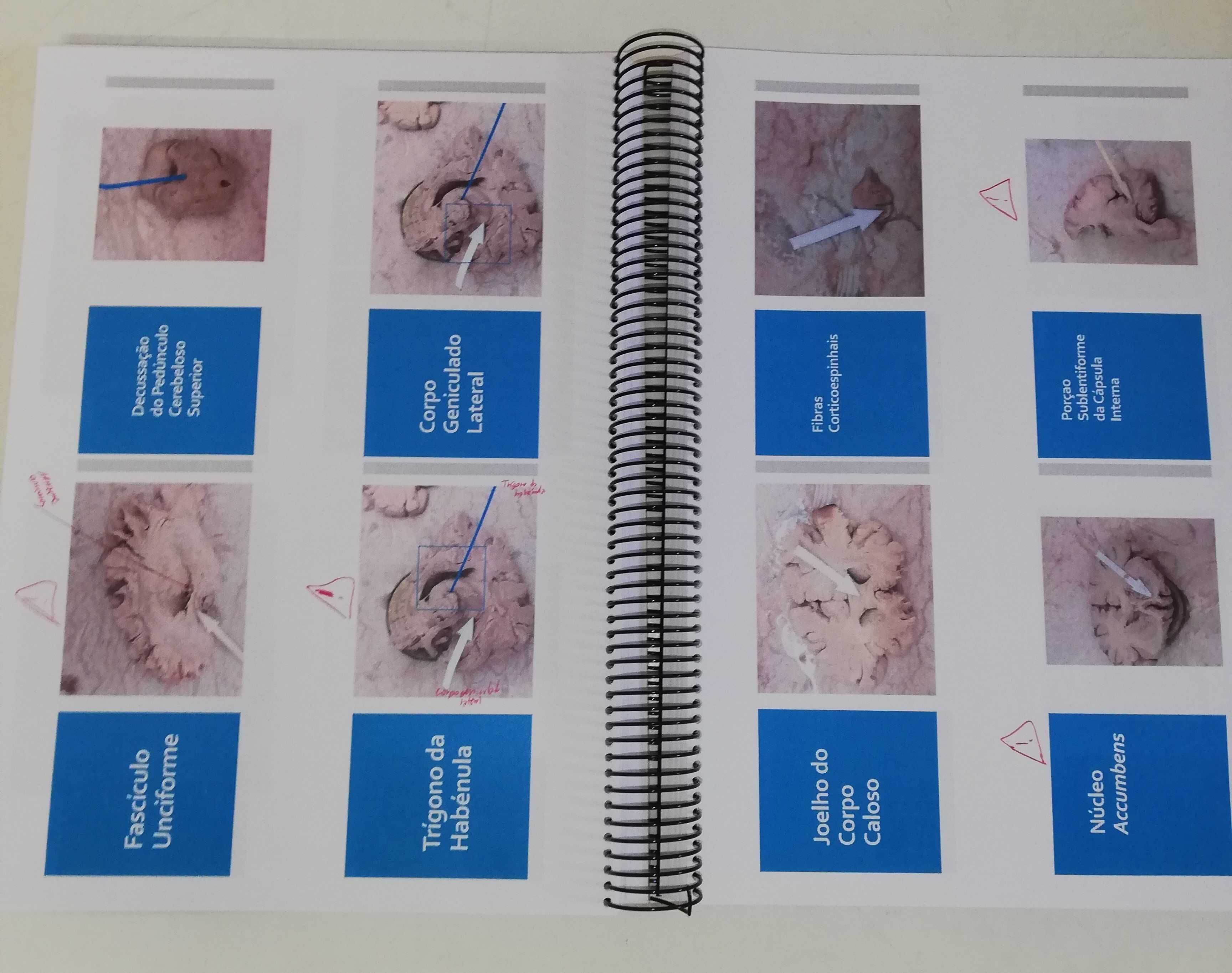 Atlas de Neuroanatomia