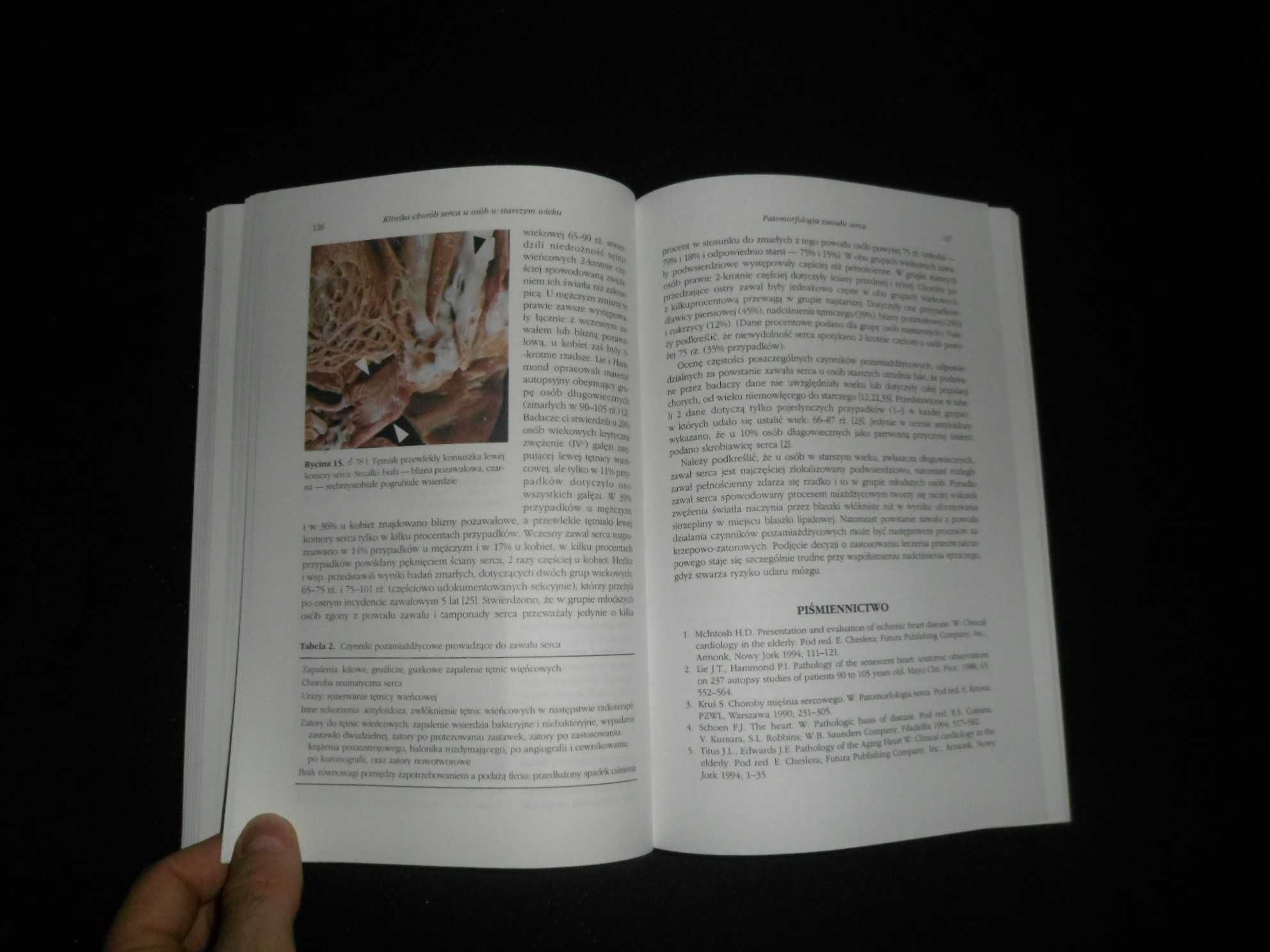 Kardiologia starszego wieku pod red. Grażyny Świąteckiej