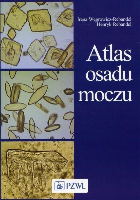 Atlas Osadu Moczu