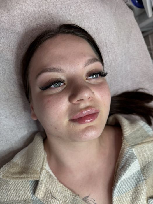 Моделі для збільшенення губ