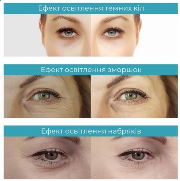 Ультразвуковой массажёр для глаз оттемных кругов и мешков под глазами