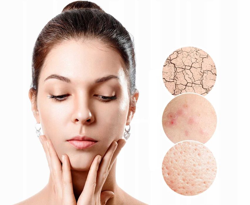 Peeling Kawitacyjny do Twarzy Ultradźwiękowy 5w1