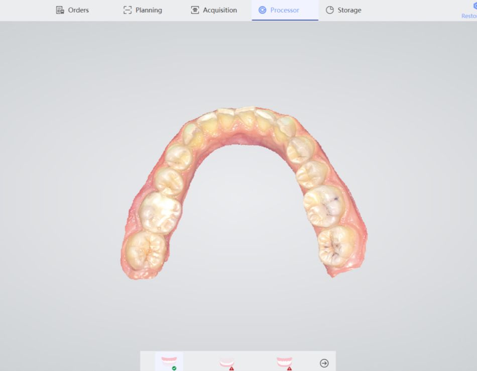 Scanner intraoral NOVO PANDA P2 Plus
