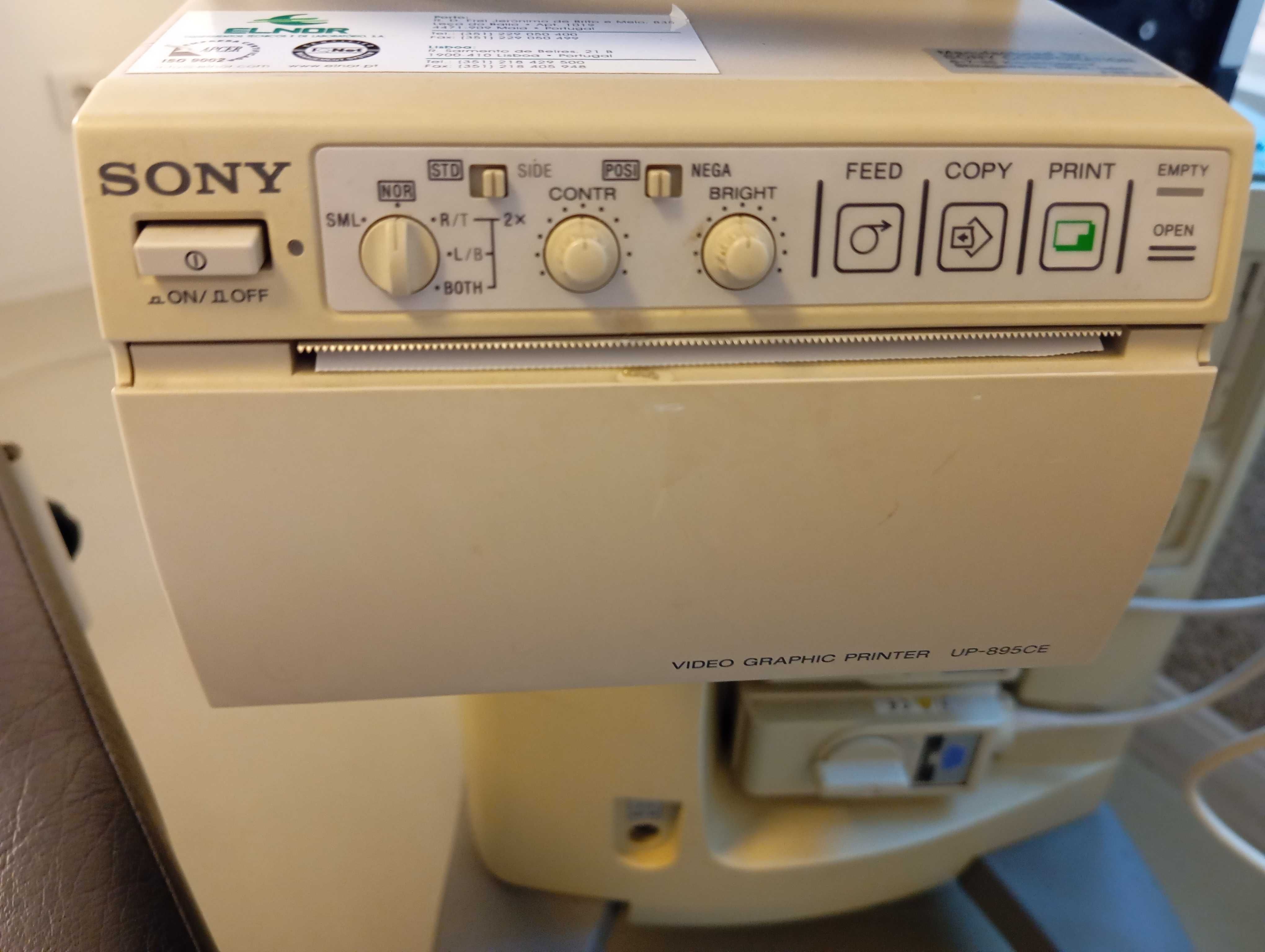equipamentos médicos - ecógrafo (ginecologia-obstetrícia)