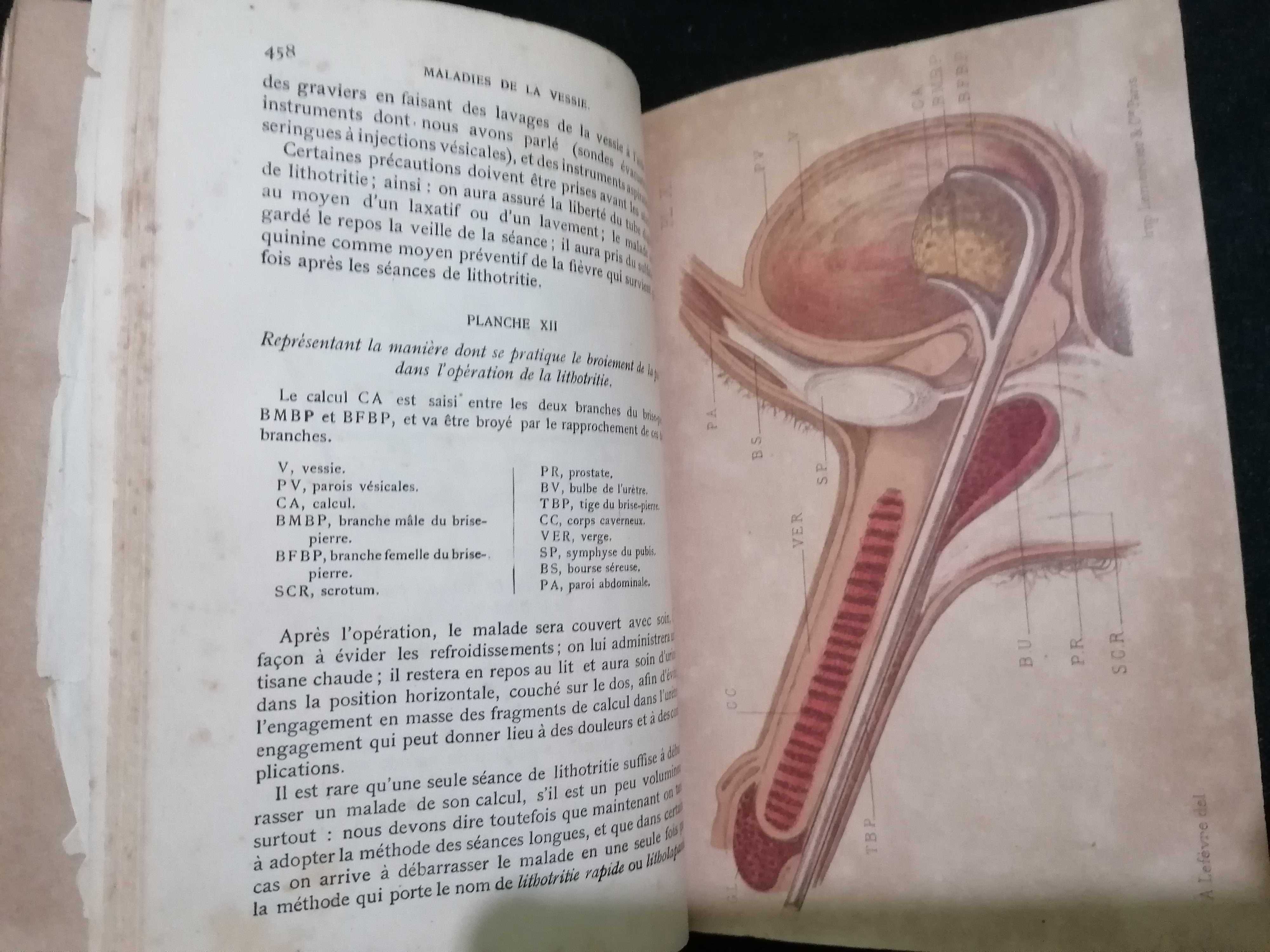 Traité Pratique des Maladies des Voies Urinaires, par Jozan Pére ,1884