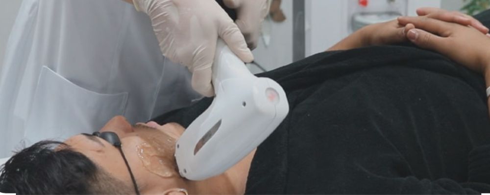 Depilacao a laser, remocao de tatuagem, peeling