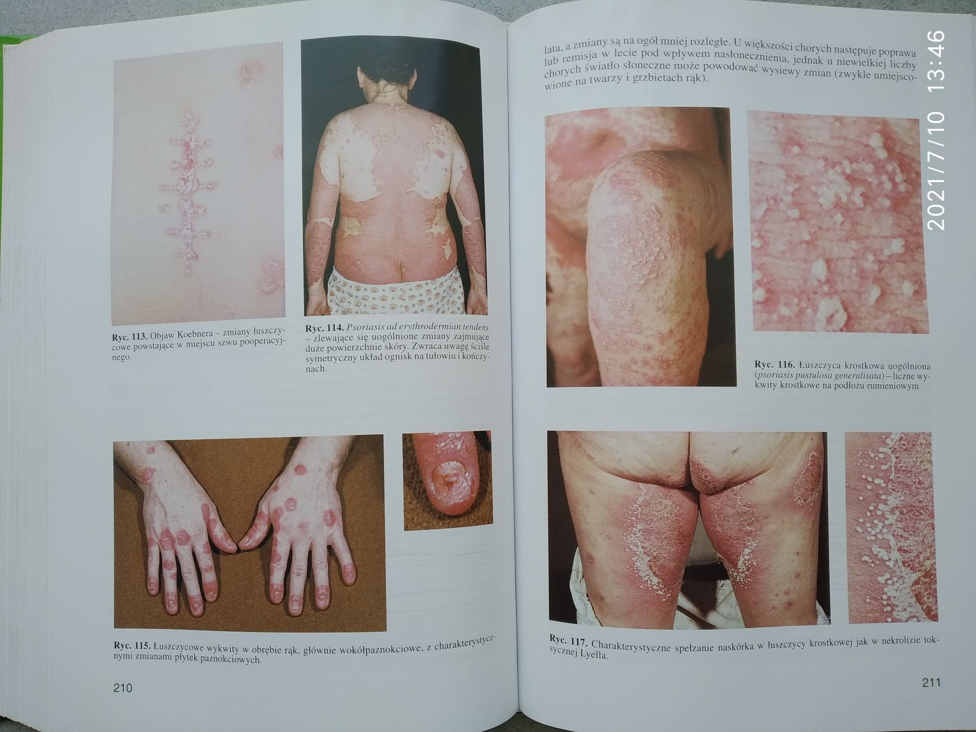 Медицинские книги по дерматовенерологии на польском языке
