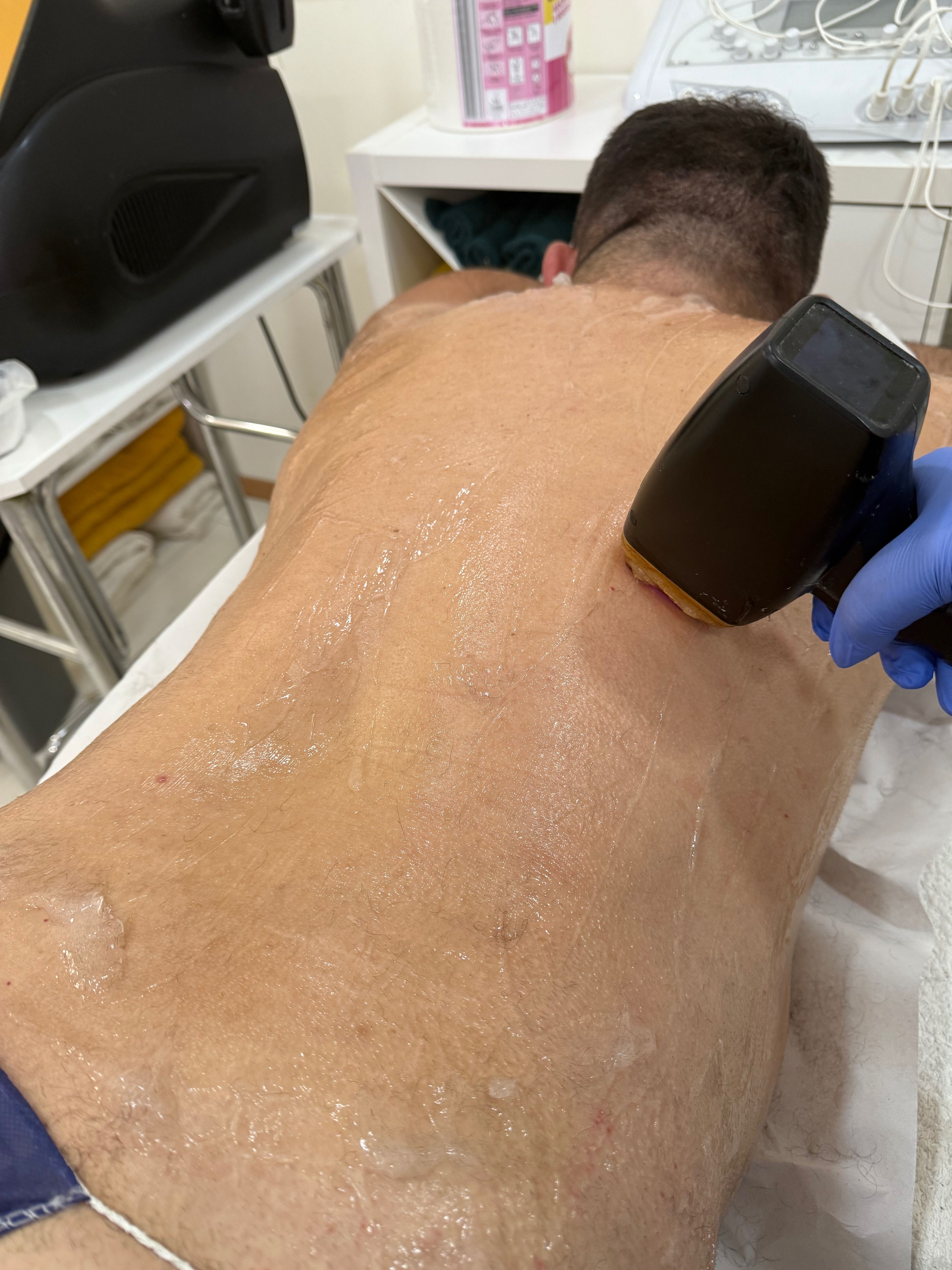 Depilação a laser Masculina