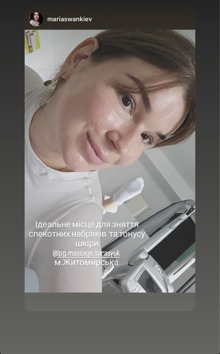 Апаратний LPG масаж корекція фігури для жінок Крюківщина 400 грн