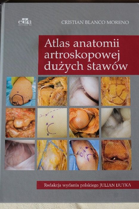 Atlas anatomii artroskopowej dużych stawów. Moreno. red. Dutka