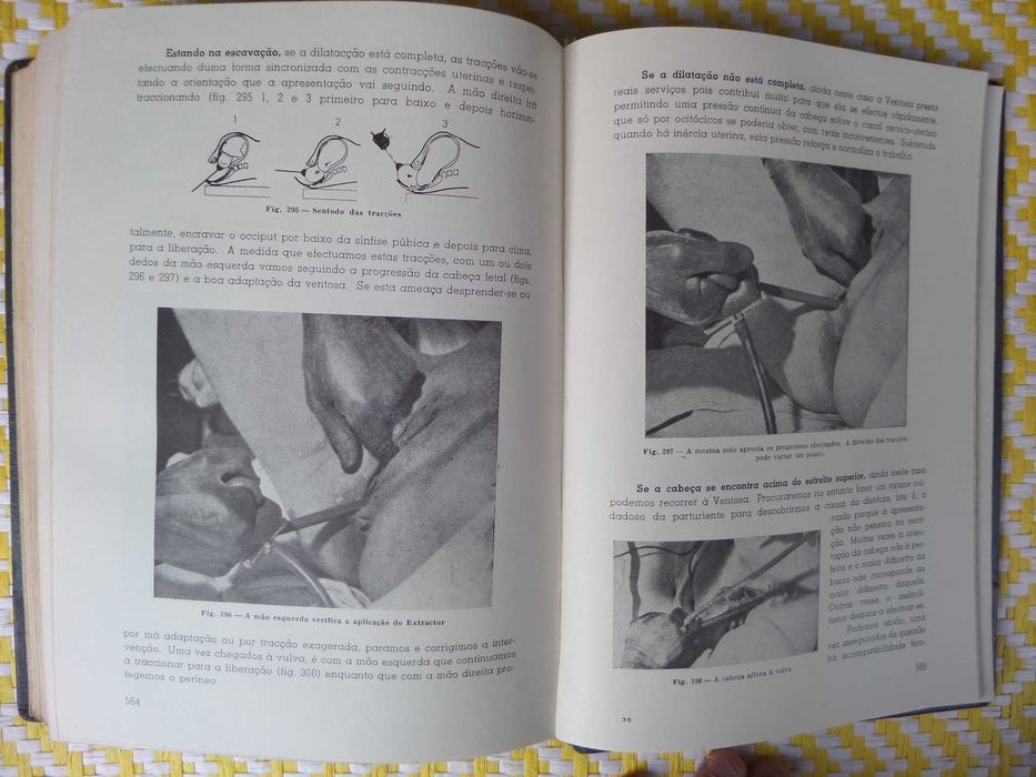 NOÇÕES DE OBSTETRÍCIA 
Aureliano Dias Gonçalves