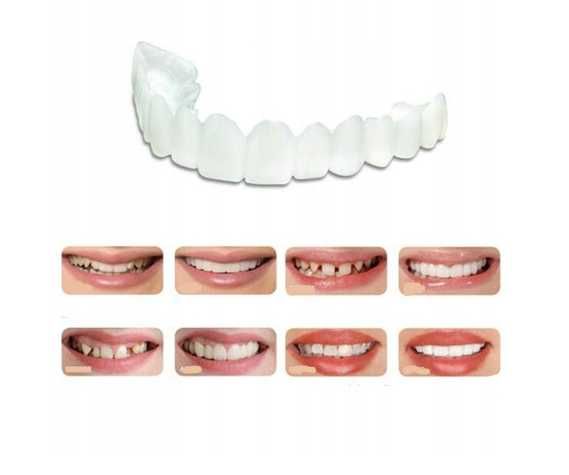IMPLANTY Sztuczne Zęby Tymczasowe Nakładki Zębów