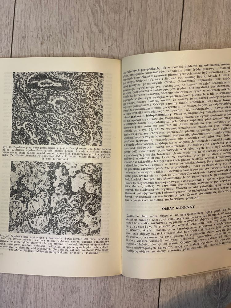 Fizjologia Noworodka i Wcześniaka 1964 Jerzykowska-Kuleszyna PZWL