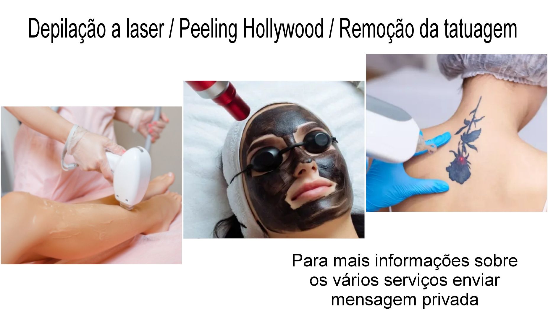 Depilação e remoção de tatuagens a laser