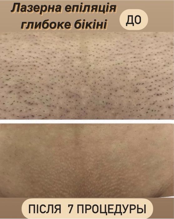 Массаж эпиляция. Только для женщин. Улица Гурова 17 ,салон Подиум