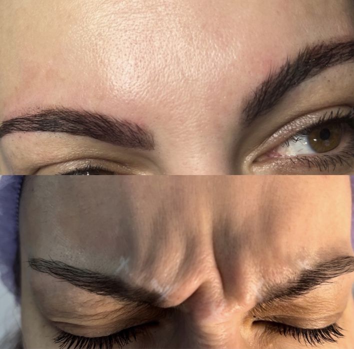 Ботокс| Все зоны | Одесса| Цент