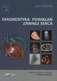 Diagnostyka powikłań zawału serca Stuart J. Hutchison kardiologia