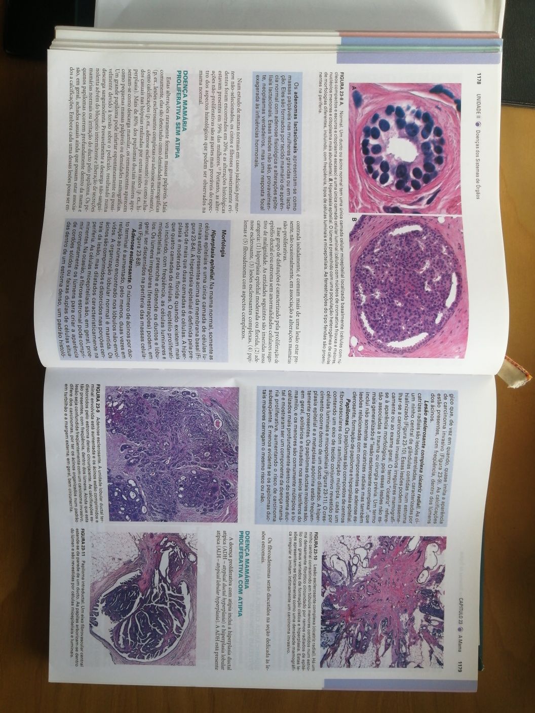 Robbins & Cotran, Patologia - Bases Patologicas das Doenças, 7ª edição