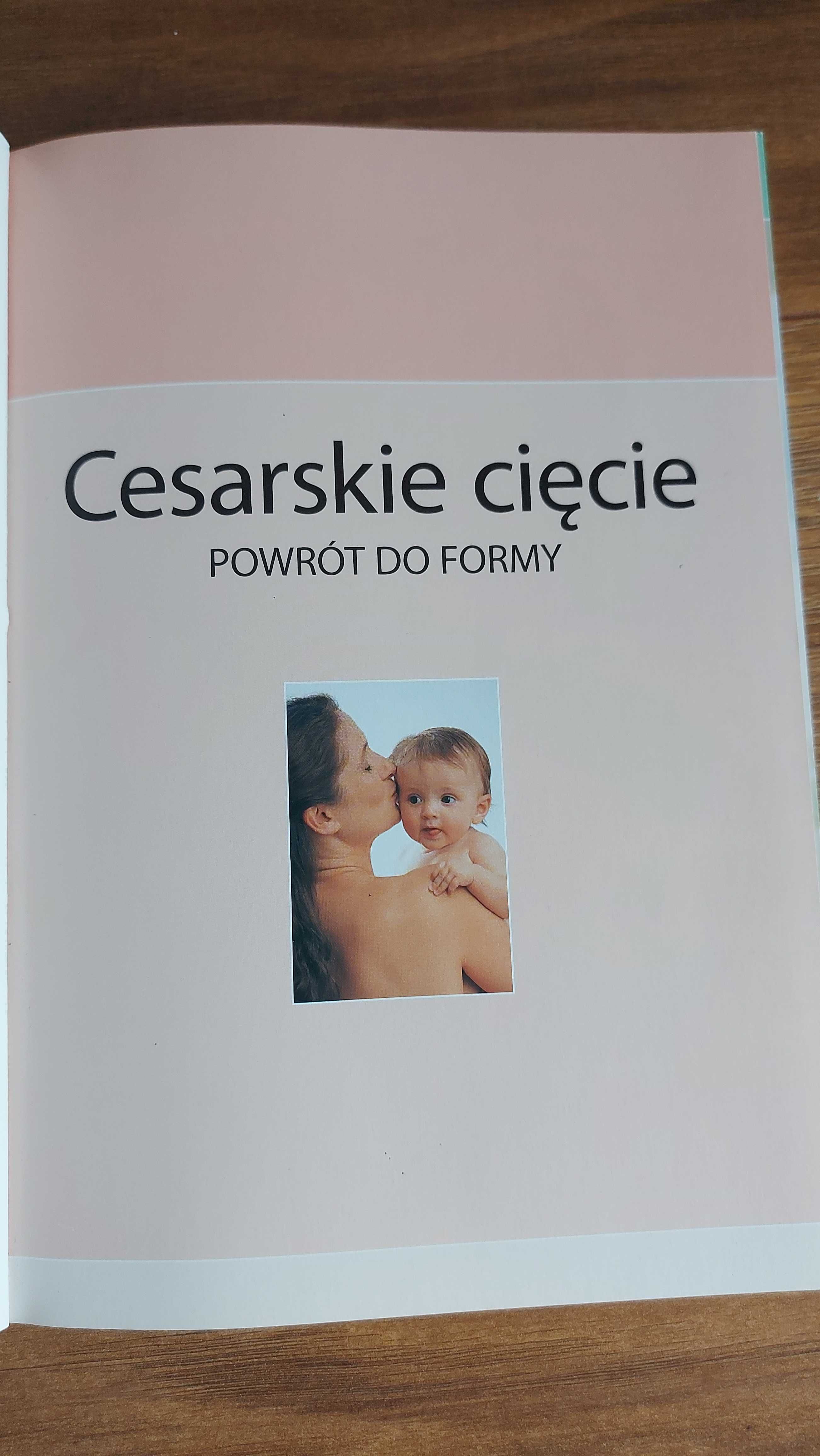 Cesarskie cięcie powrót do formy (książka)