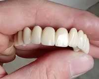 Зубний технік пропонує співпрацю лікарям Стоматологам.