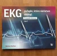 EKG- pułapki, które niełatwo ominąć. Przypadki kliniczne