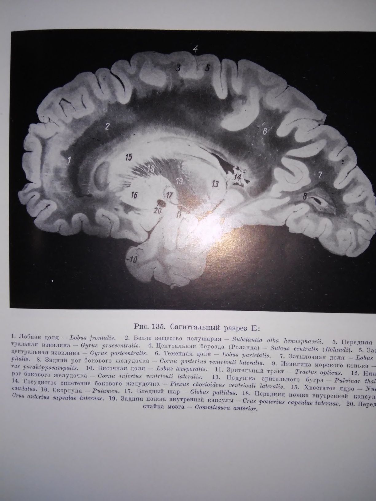 Стэльмасяк Анатомический атлас головного спинного мозга 1956 р.