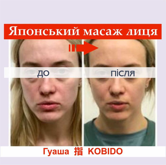 Японський масаж обличчя Кобідо | Массаж лица | Позняки/Осокорки