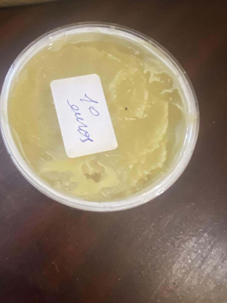 Creme Caseiro Para Queimaduras