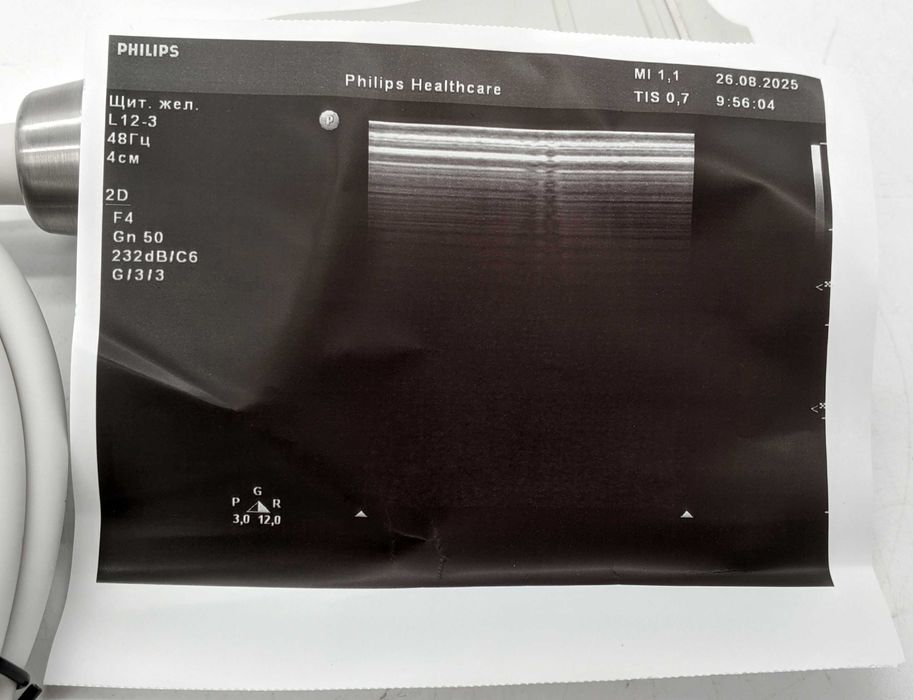 Лінійний УЗД датчик Philips L12-3