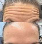 BoToX - 200 zł. za 1 okolicę, 500 zł. - 3 okolice + GRATIS lip flip.