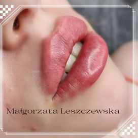 Powiększanie ust 500zł/1ml, kwas, botox 250zl