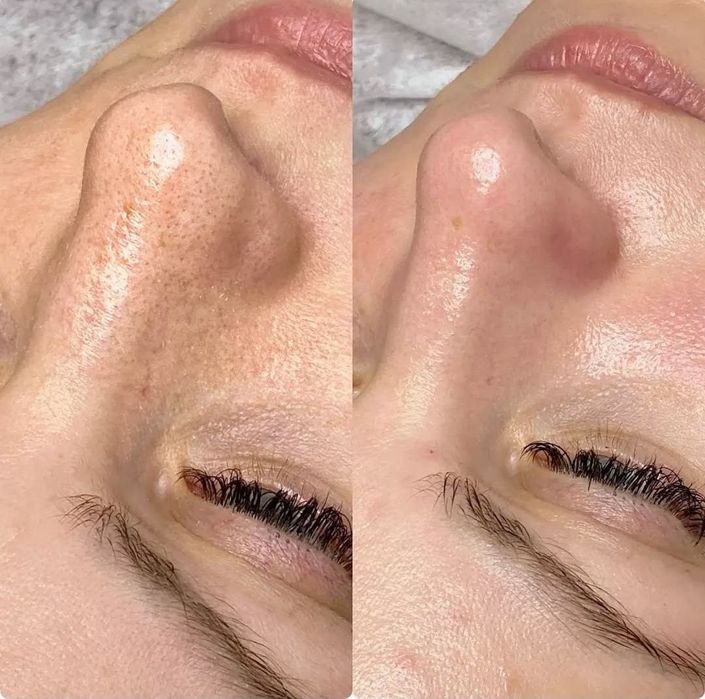 Косметолог | Київ, Позняки