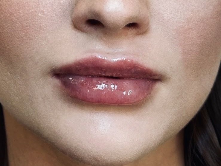 Powiększanie Ust 350/1ml