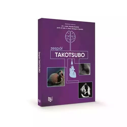 Zespół takotsubo. Item Publishing
