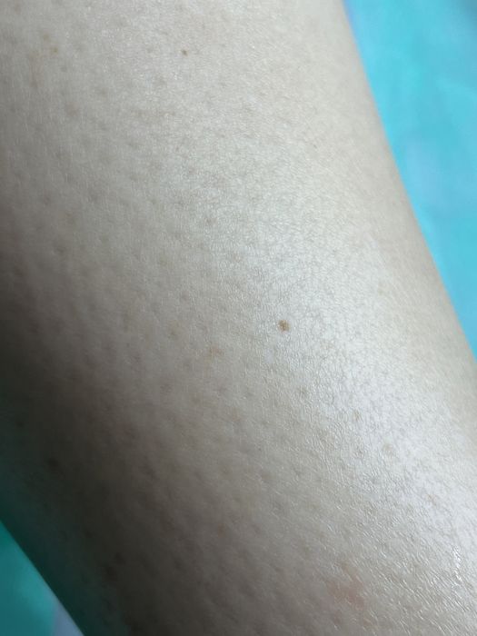 Шугаринг Депиляция воском, сахаром пос. Котовского/Амазонка