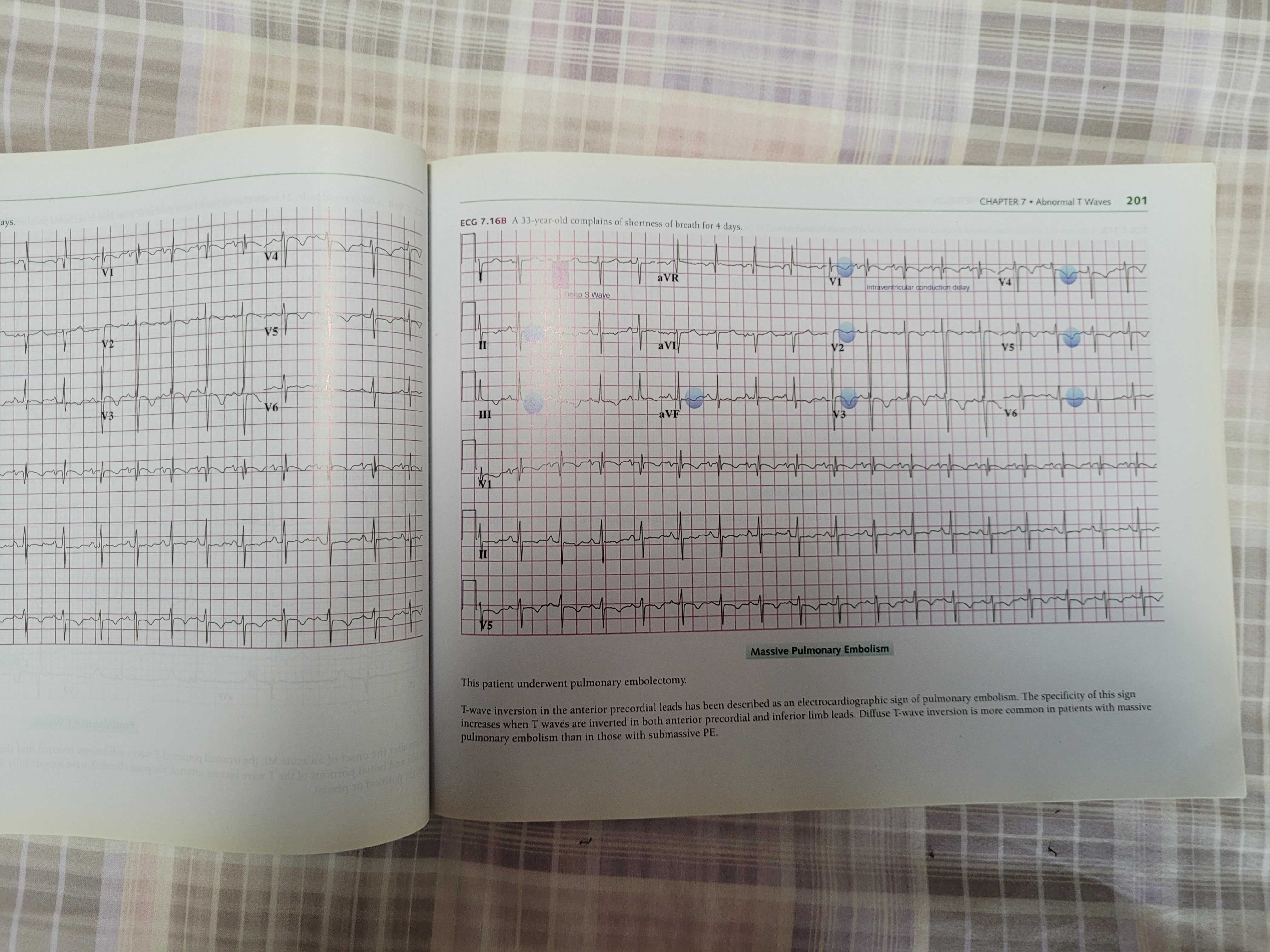 Medicina "A visual Guide to ECG interpretation" da Wolters Kluwer