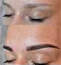 Косметолог удалени бородаво папилом Пудренные брови чистка лица азотом