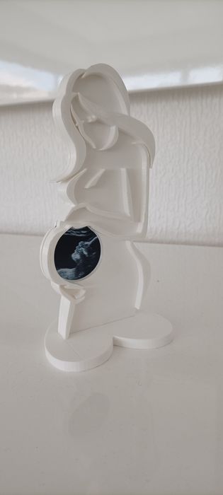 Moldura gravida ecografia