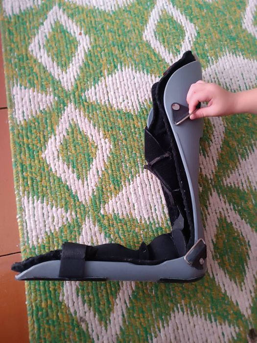 Шина на ногу після перелому