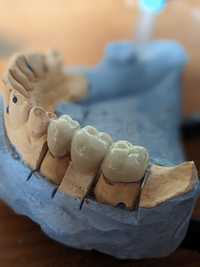 Зубной техник. Сотрудничество для стоматологов