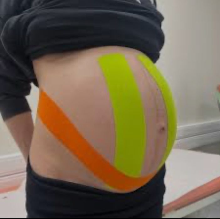 Видео курс по самотейпированию беременных Тейпування вагітних