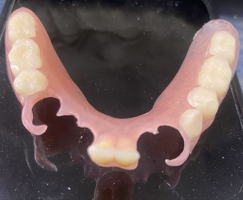 Confeccao de protese em geral