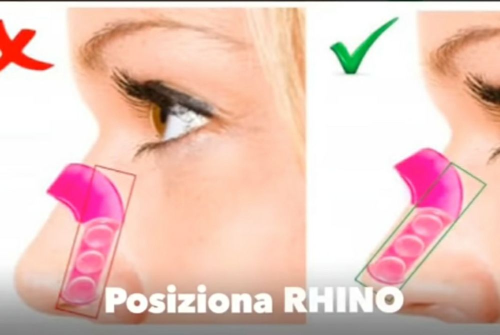 Corrector de nariz